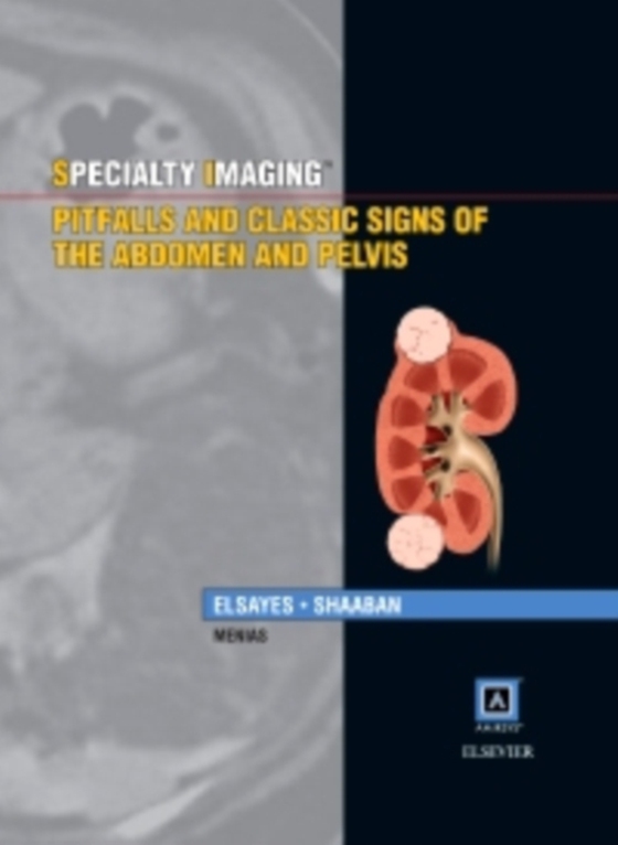 Specialty Imaging: Pitfalls and Classic Signs of the Abdomen and Pelvis E-Book (e-bog) af Shaaban, Akram M