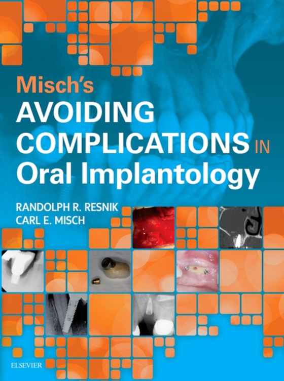 Misch's Avoiding Complications in Oral Implantology (e-bog) af Resnik, Randolph