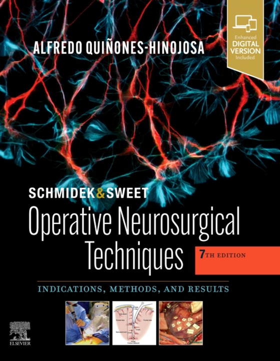 Schmidek and Sweet: Operative Neurosurgical Techniques E-Book (e-bog) af Quinones-Hinojosa, Alfredo