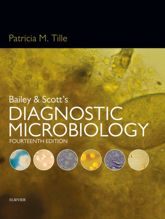 Bailey & Scott's Diagnostic Microbiology - E-Book (e-bog) af Tille, Patricia M.