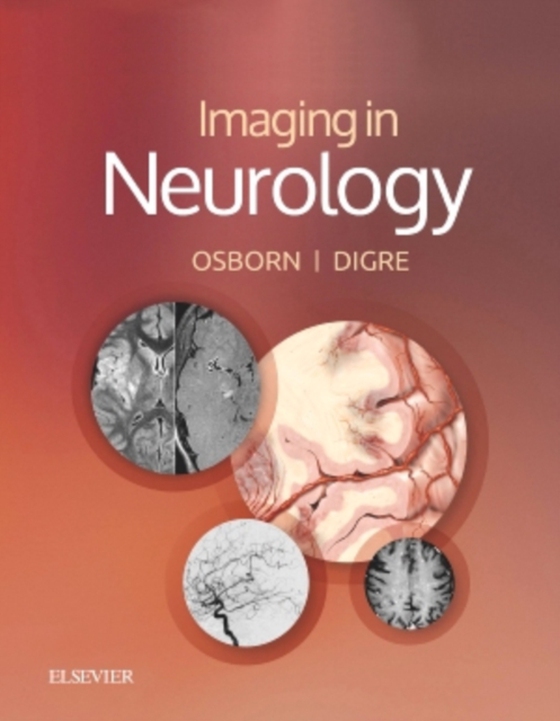 Imaging in Neurology E-Book (e-bog) af Digre, Kathleen B.