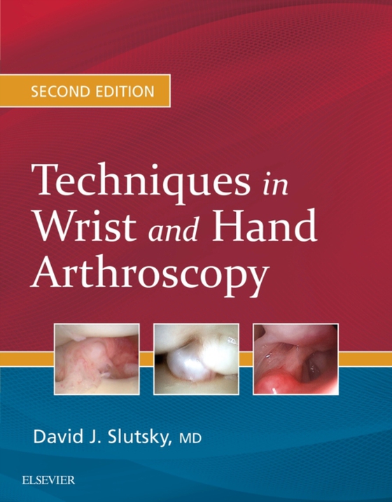 Techniques in Wrist and Hand Arthroscopy E-Book (e-bog) af Slutsky, David J.