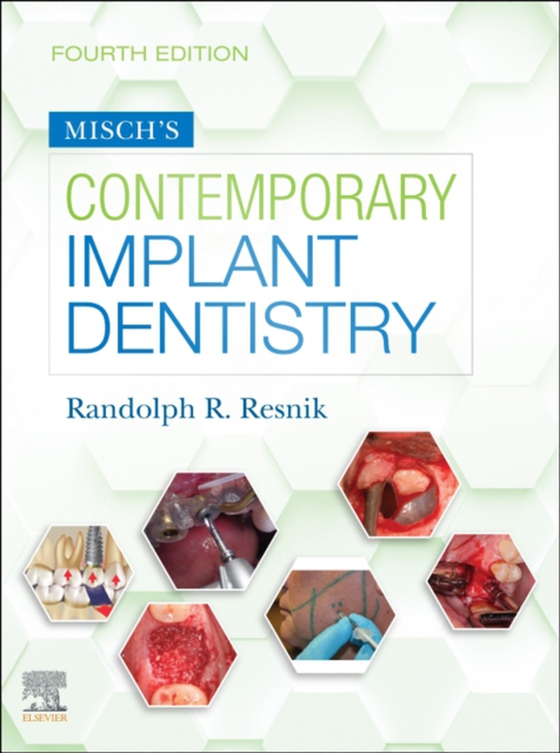 Misch's Contemporary Implant Dentistry E-Book (e-bog) af Resnik, Randolph