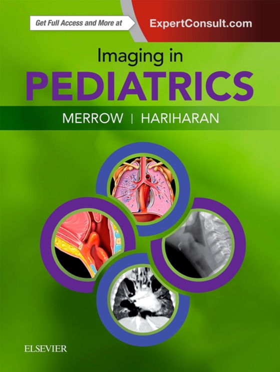 Imaging in Pediatrics E-Book (e-bog) af Hariharan, Selena