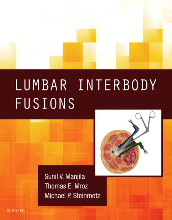 Lumbar Interbody Fusions E-Book (e-bog) af Steinmetz, Michael P.