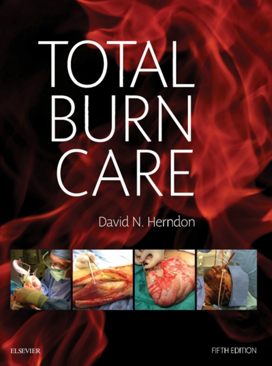 Total Burn Care E-Book (e-bog) af Herndon, David N.