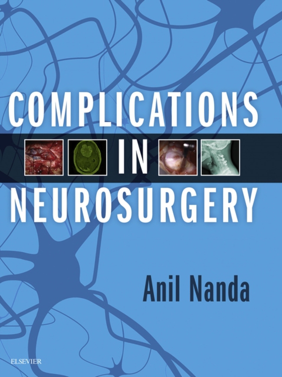 Complications in Neurosurgery E-Book (e-bog) af -