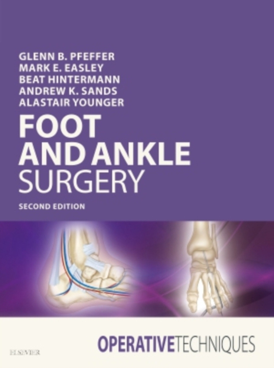 Operative Techniques: Foot and Ankle Surgery E-Book (e-bog) af Younger, Alastair S. E.