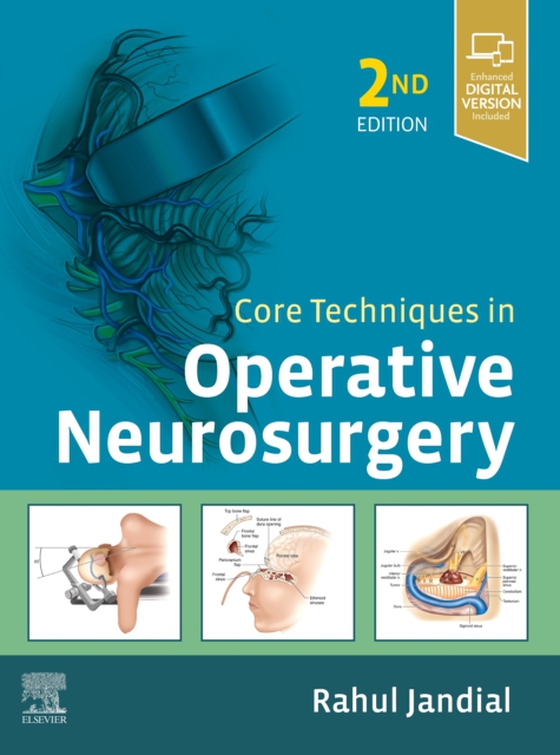 Core Techniques in Operative Neurosurgery E-Book