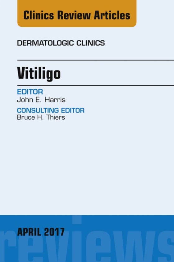 Vitiligo, An Issue of Dermatologic Clinics (e-bog) af Harris, John E.