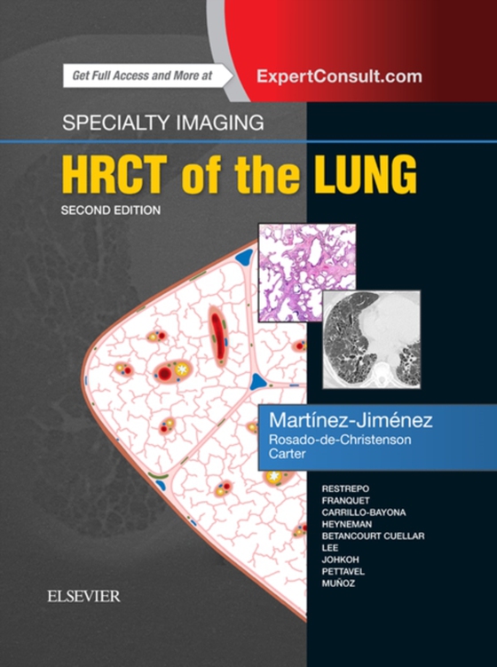 Specialty Imaging: HRCT of the Lung E-Book (e-bog) af Carter, Brett W.