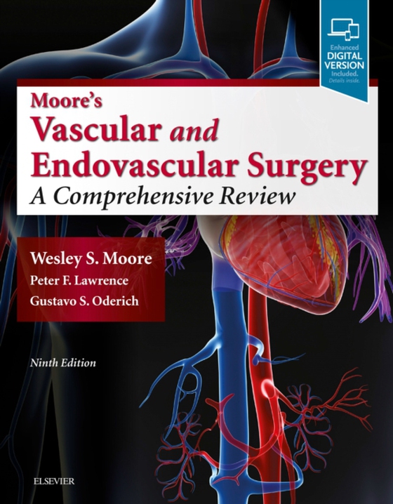 Moore's Vascular and Endovascular Surgery E-Book (e-bog) af Moore, Wesley S.