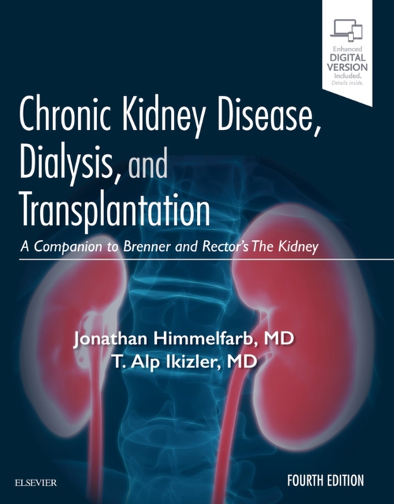Chronic Kidney Disease, Dialysis, and Transplantation E-Book (e-bog) af Ikizler, T. Alp
