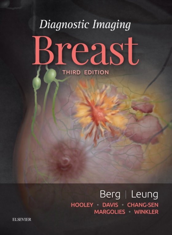 Diagnostic Imaging: Breast E-Book (e-bog) af Leung, Jessica