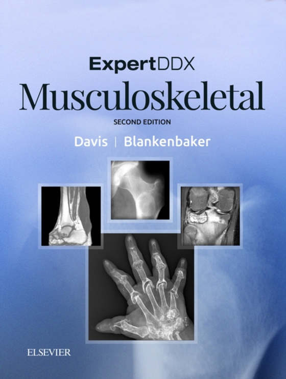 ExpertDDx: Musculoskeletal E-Book (e-bog) af Blankenbaker, Donna G