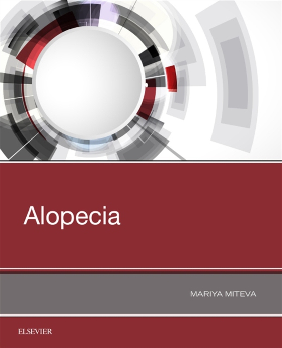 Alopecia