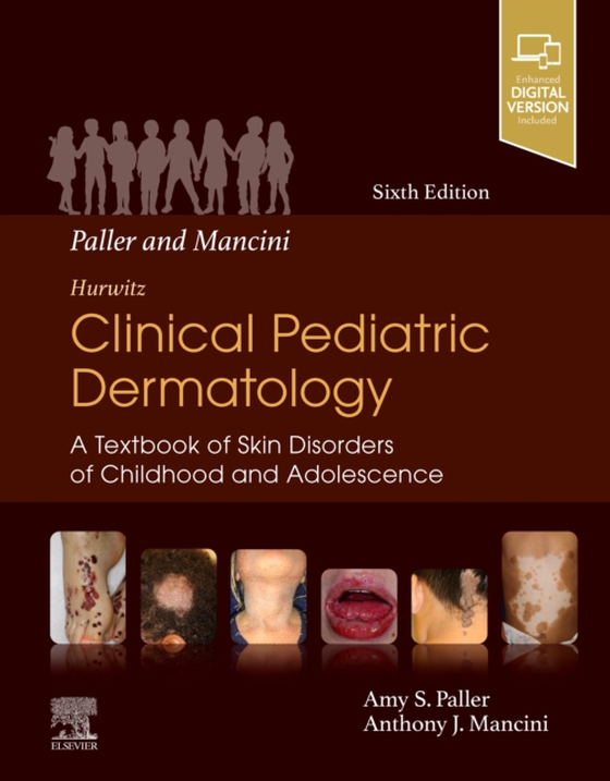 Paller and Mancini - Hurwitz Clinical Pediatric Dermatology E-Book (e-bog) af Mancini, Anthony J.