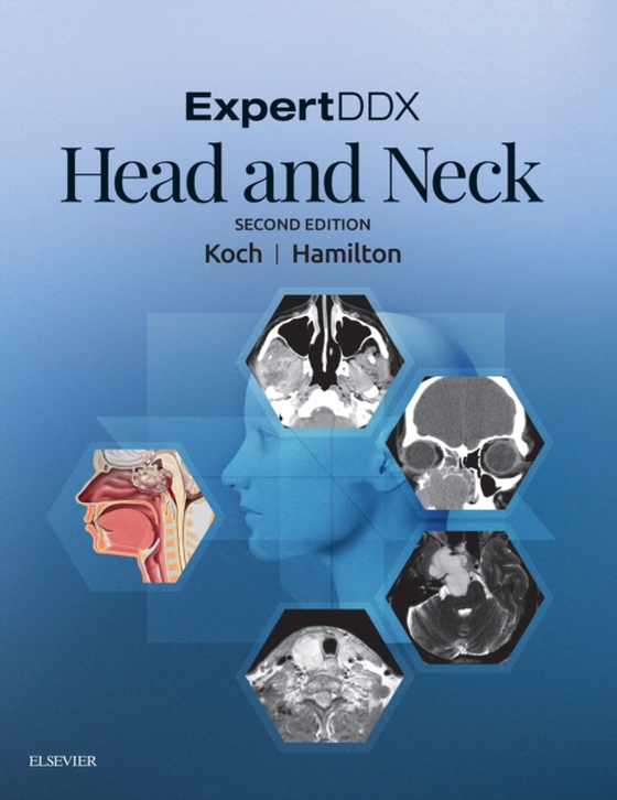 ExpertDDX: Head and Neck - E-Book (e-bog) af Hamilton, Bronwyn E.