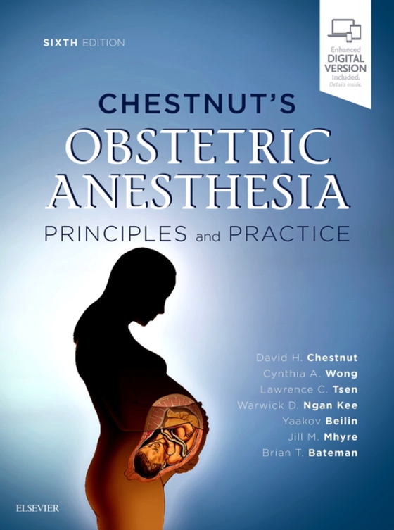 Chestnut's Obstetric Anesthesia E-Book (e-bog) af Nathan, Naveen