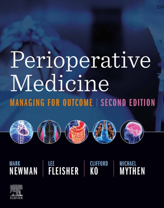 Perioperative Medicine E-Book (e-bog) af Mythen, Michael (Monty)