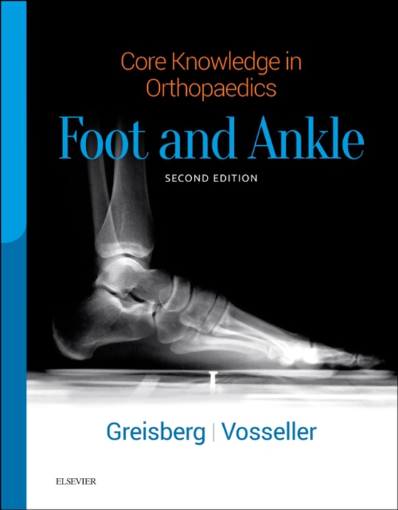 Core Knowledge in Orthopaedics: Foot and Ankle E-Book (e-bog) af Vosseller, J. Turner