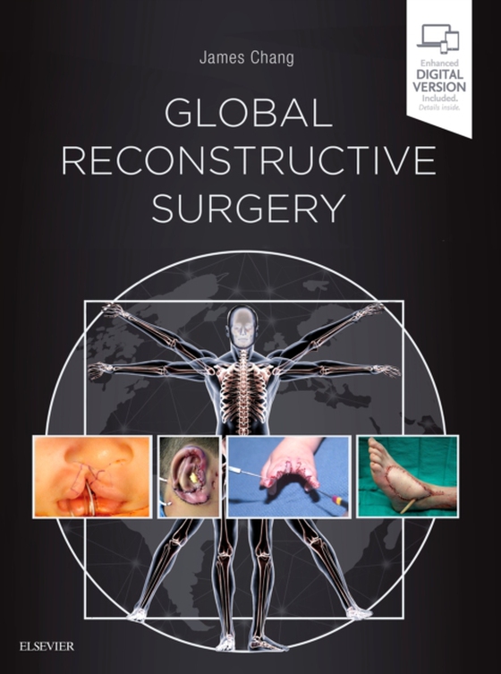 Global Reconstructive Surgery (e-bog) af Chang, James