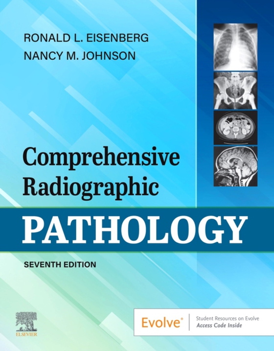 Comprehensive Radiographic Pathology E-Book (e-bog) af Johnson, Nancy M.