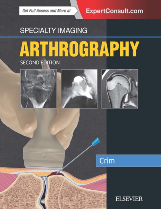 Specialty Imaging: Arthrography E-Book (e-bog) af Crim, Julia R.