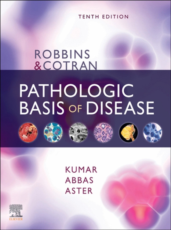 Robbins & Cotran Pathologic Basis of Disease E-Book (e-bog) af Aster, Jon C.