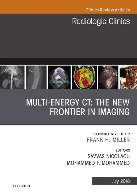 Multi-Energy CT: The New Frontier in Imaging, An Issue of Radiologic Clinics of North America (e-bog) af Mohammed, Mohammed F.