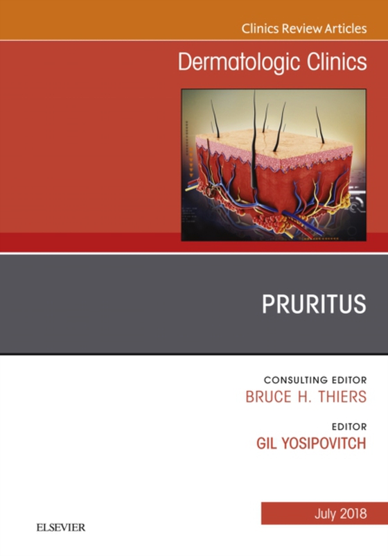 Pruritus, An Issue of Dermatologic Clinics (e-bog) af Yosipovitch, Gil