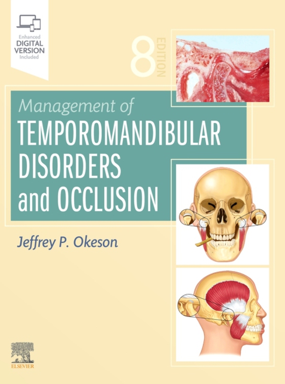 Management of Temporomandibular Disorders and Occlusion - E-Book (e-bog) af Okeson, Jeffrey P.