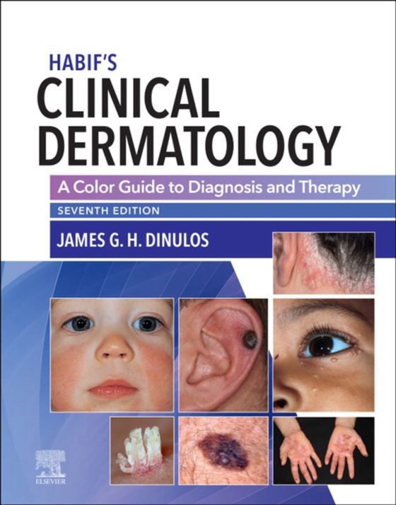 Habif' Clinical Dermatology E-Book (e-bog) af Dinulos, James G.