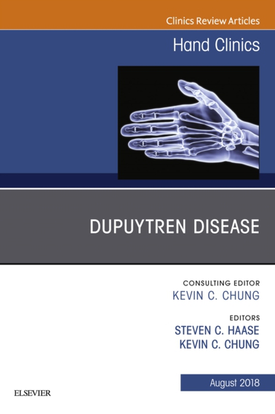 Dupuytren Disease, An Issue of Hand Clinics (e-bog) af Chung, Kevin C.