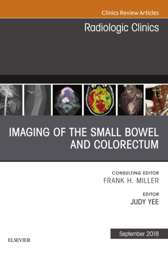 Imaging of the Small Bowel and Colorectum, An Issue of Radiologic Clinics of North America (e-bog) af Yee, Judy