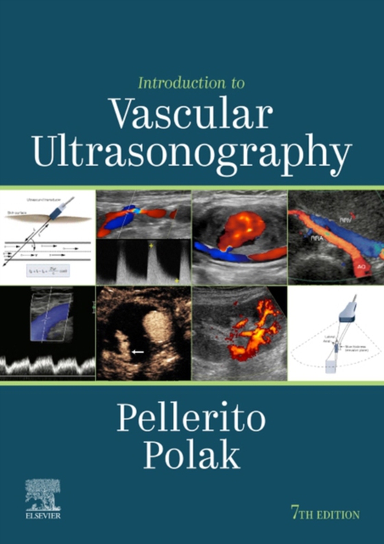 Introduction to Vascular Ultrasonography E-Book (e-bog) af Polak, Joseph F.