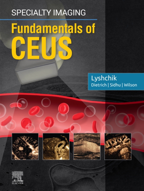 Specialty Imaging: Fundamentals of CEUS E-Book (e-bog) af Lyshchik, Andrej