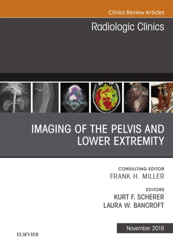 Imaging of the Pelvis and Lower Extremity, An Issue of Radiologic Clinics of North America (e-bog) af Scherer, Kurt