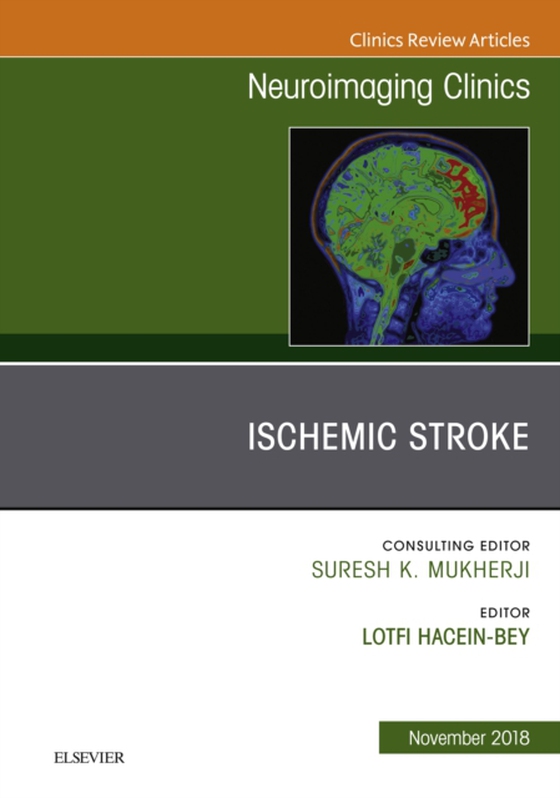 Ischemic Stroke, An Issue of Neuroimaging Clinics of North America (e-bog) af Hacein-Bey, Lotfi