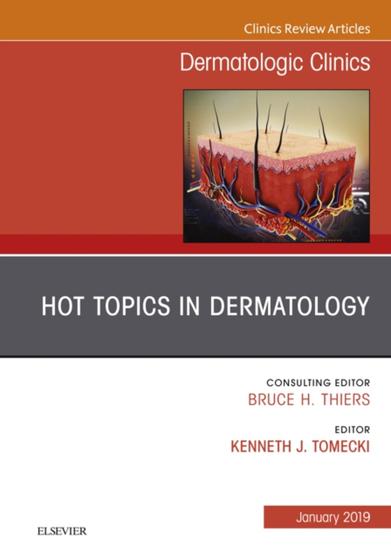 Hot Topics in Dermatology, An Issue of Dermatologic Clinics (e-bog) af Kenneth, Tomecki J