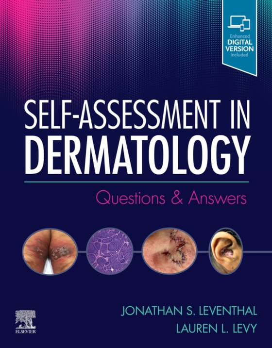 Self-Assessment in Dermatology E-Book (e-bog) af Levy, Lauren