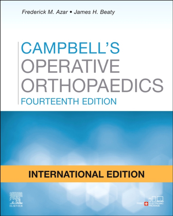 Campbell's Operative Orthopaedics, E-Book (e-bog) af Beaty, James H.