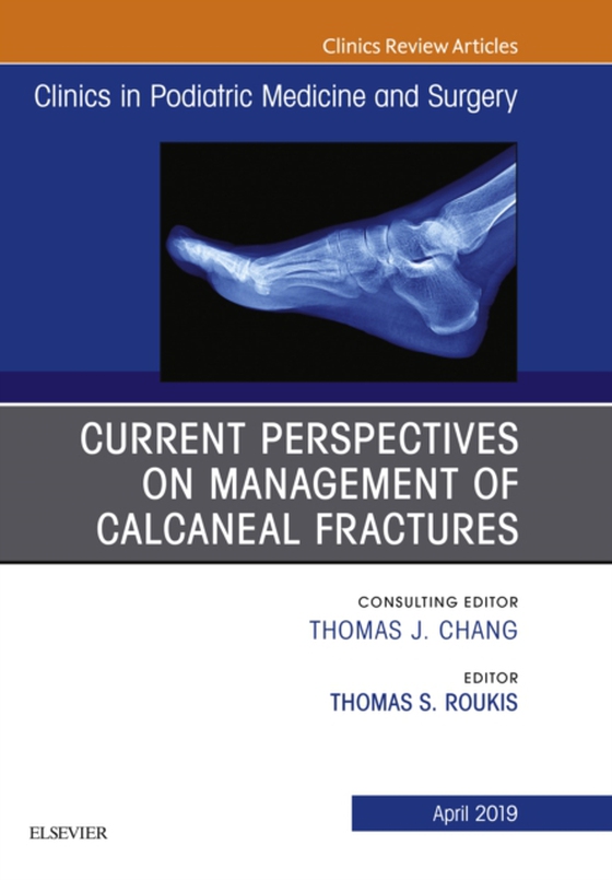 Current Perspectives on Management of Calcaneal Fractures, An Issue of Clinics in Podiatric Medicine and Surgery (e-bog) af Roukis, Thomas S.