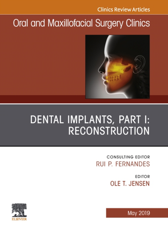 Dental Implants, Part I: Reconstruction, An Issue of Oral and Maxillofacial Surgery Clinics of North America (e-bog) af Jensen, Ole