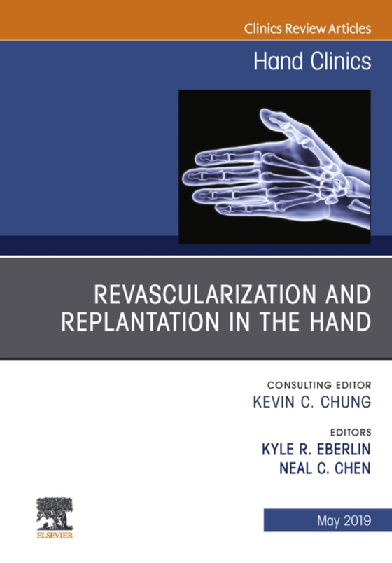 Revascularization and Replantation in the Hand, An Issue of Hand Clinics (e-bog) af Chen, Neal