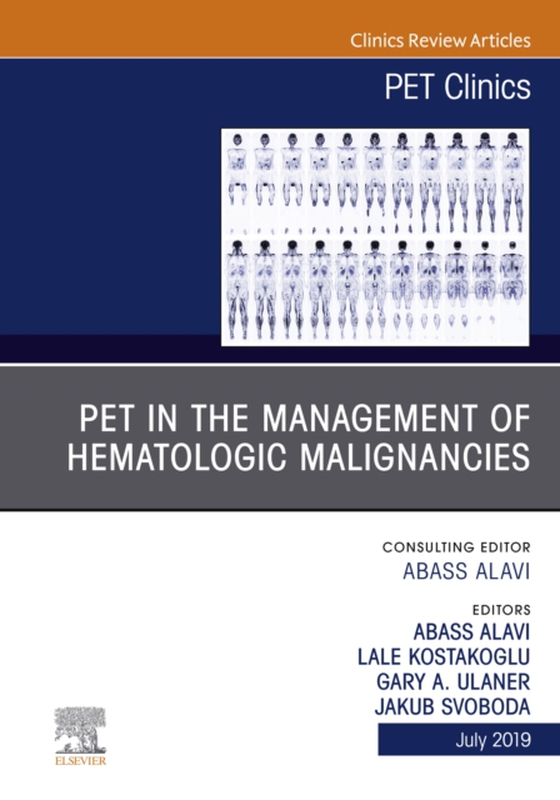 PET in the Management of Hematologic Malignancies, An Issue of PET Clinics (e-bog) af -