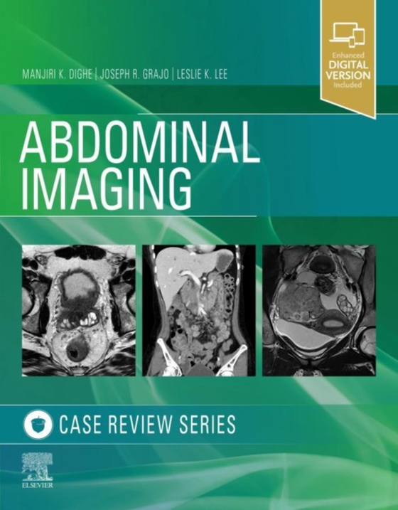 Abdominal Imaging (e-bog) af Lee, Leslie