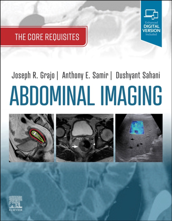 Abdominal Imaging E-Book (e-bog) af Samir, Anthony E