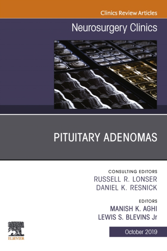 Pituitary Adenoma, An Issue of Neurosurgery Clinics of North America (e-bog) af -