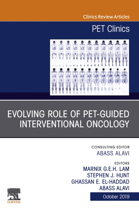 Evolving Role of PET-guided Interventional Oncology, An Issue of PET Clinics (e-bog) af -